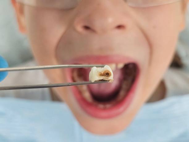 Best Cracked Tooth Emergency Dentist  in Smithville, TN